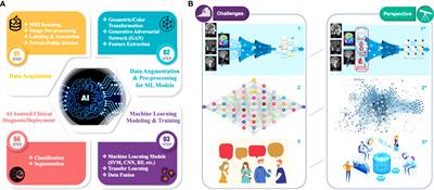 Artificial intelligence in the radiomic analysis of glioblastomas: A review, taxonomy, and perspective